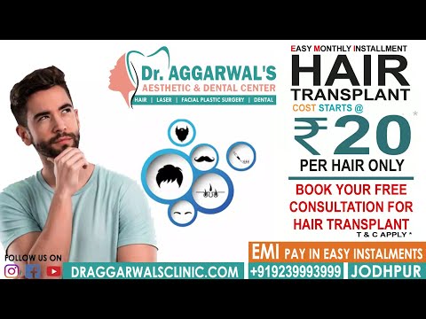 Hair Transplant Procedure | हेयर ट्रांसप्लांट कैसे होता है  | Dr. Aggarwal's Clinic Jodhpur.