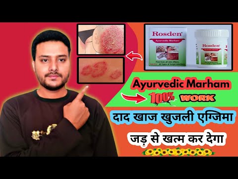 Rosden Ayurvedic malam,forWomens health Cream ,Liniment, Lotion,Gel ,Paste