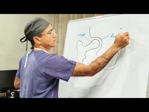 Complications of Fracture Neck of Femur