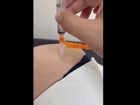 Trochanteric Bursa Injection