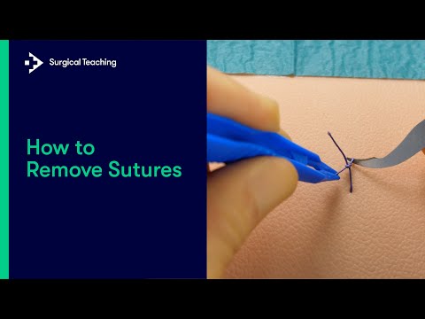 How to Remove Sutures