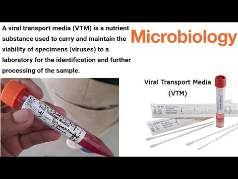 Malaria Test Kits