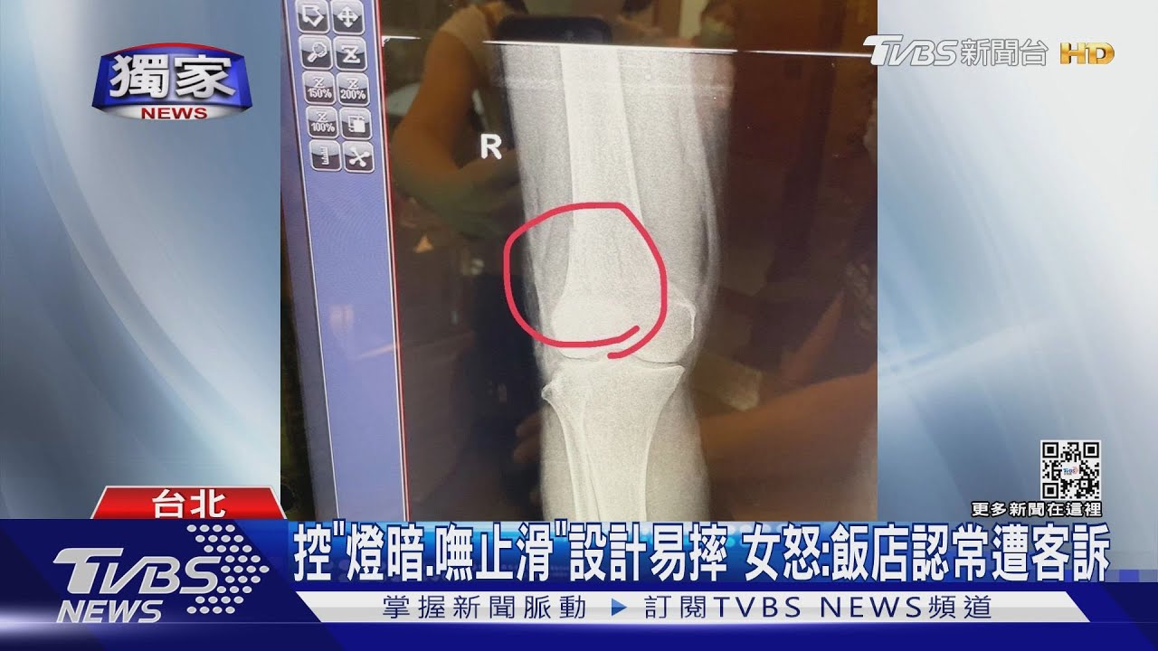 痛...70歲母踩空摔「骨裂」　女控「虹夕諾雅」消極
