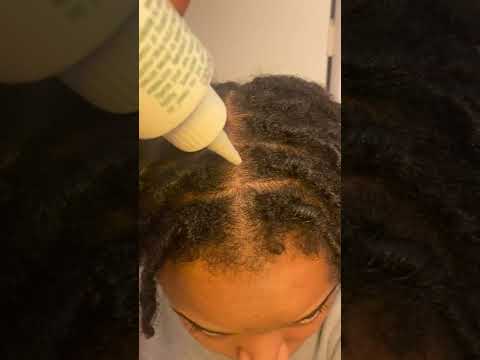 Wild Grow Oil for Scalp/locs? #instantlocs #dreadsjourney #locs #starterlocs