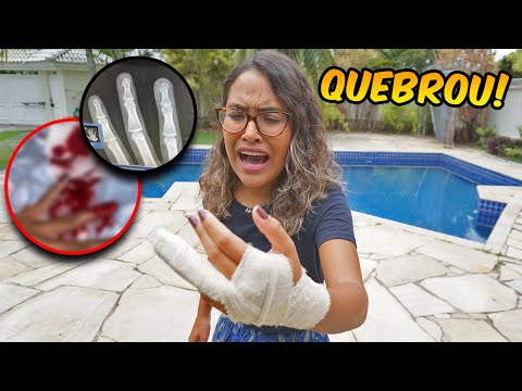 QUEBREI MEU DEDO EM DUAS PARTES! - (DEU RUIM)