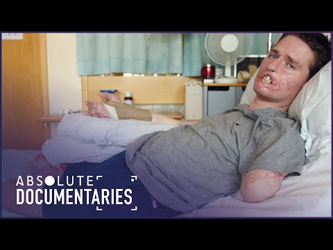 From A Common Cold To Losing My Limbs: Alex Lewis Story | Absolute Documentaries