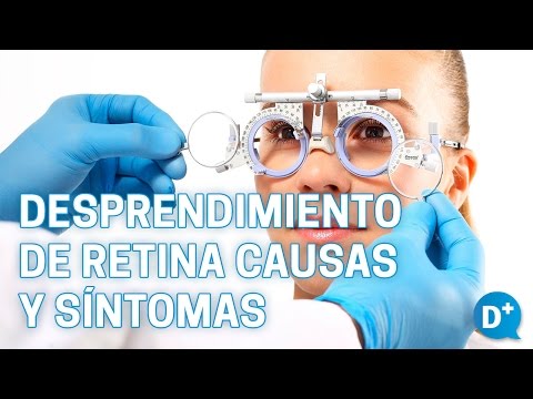 Causas y síntomas del desprendimiento de retina