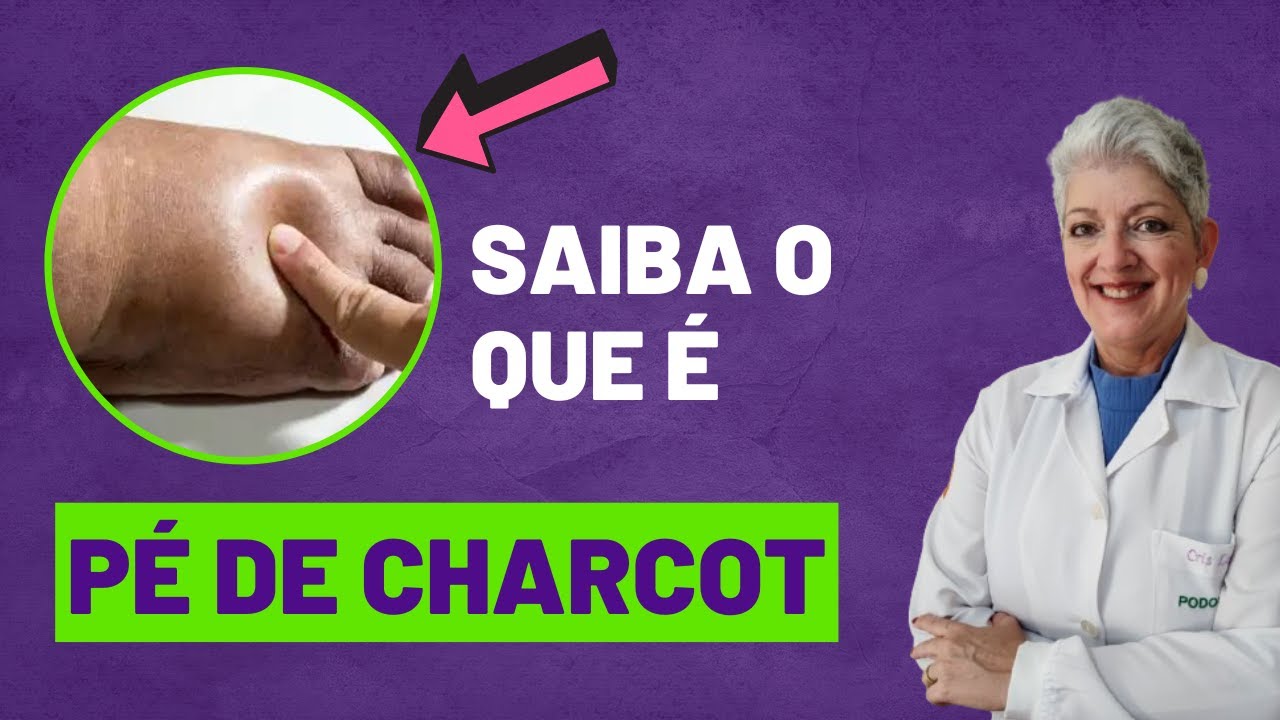 PÉ DE CHARCOT Saiba o que é