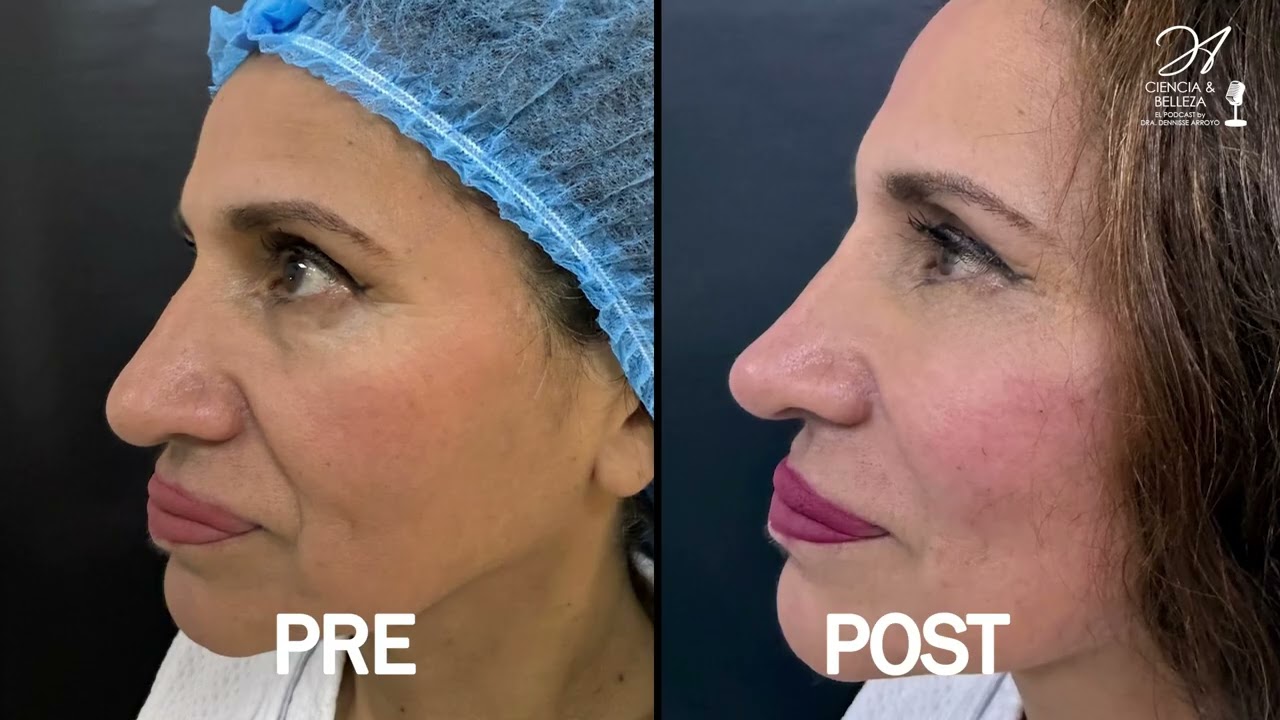 Miniatura del episodio: CAPÍTULO 7: Visage 3D con HarmonyCa — Ciencia y Belleza