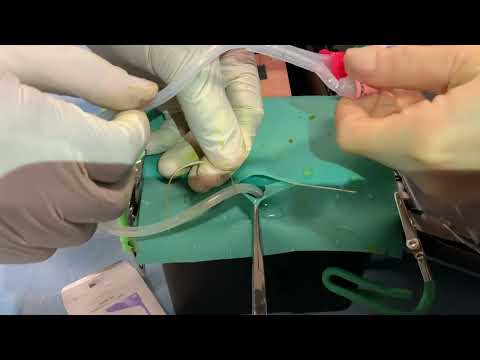 Cystostomy Placement