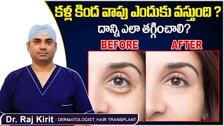 కళ్ల కింద వాపు తగ్గుతుందిలా.! | How To Reduce Under Eye Swelling Telugu | Skincare | Celestee Clinic