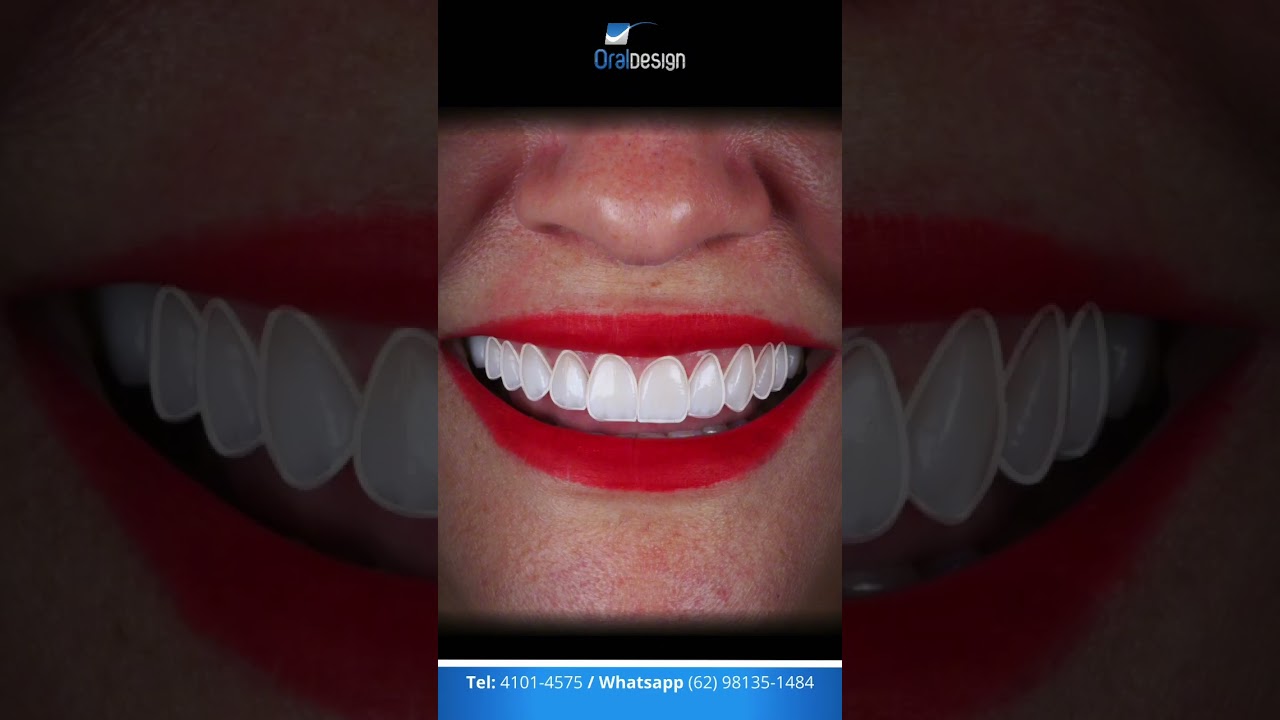 Danilo Monteiro Rezende Pereira-54