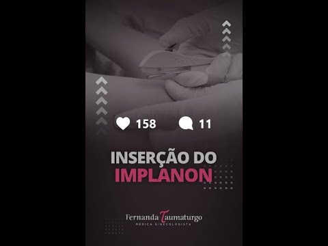 Vídeo: Como colocar Implanon: perguntas sobre o procedimento