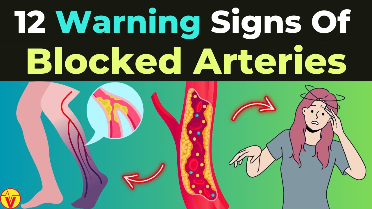 12 Signs Of Artery Blockages You Shouldn't Ignore | Silent Signs of Blocked Arteries | VisitJoy
