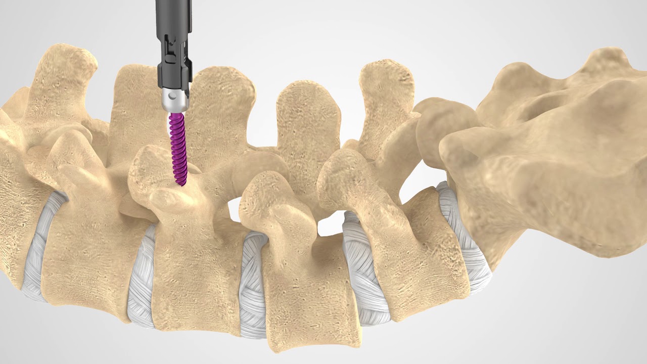 Daniele Millimaggi-22