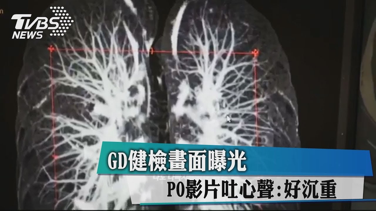 GD健檢畫面曝光　PO影片吐心聲：好沉重