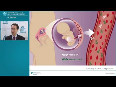 Prenatal Diagnosis of Down Syndrome: Delivering Results in our New Age of Genetic Testing