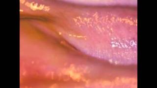 Autre Ne Veut - Sweetheart