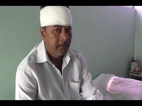 जनता मारते अधिकारी चौकशीही करीत नाहीत