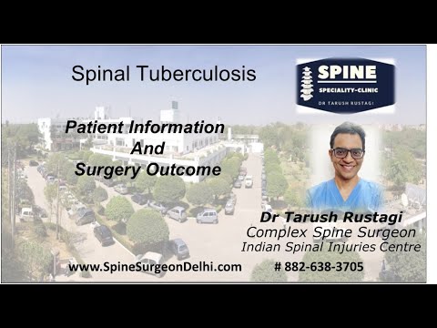 Speciality Spine Clinic. Dr Tarush Rustagi|IAA Colony,New Delhi