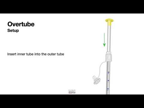 HCC 1472-Lesson 12d-Foreign Body Retrieval-Overtube