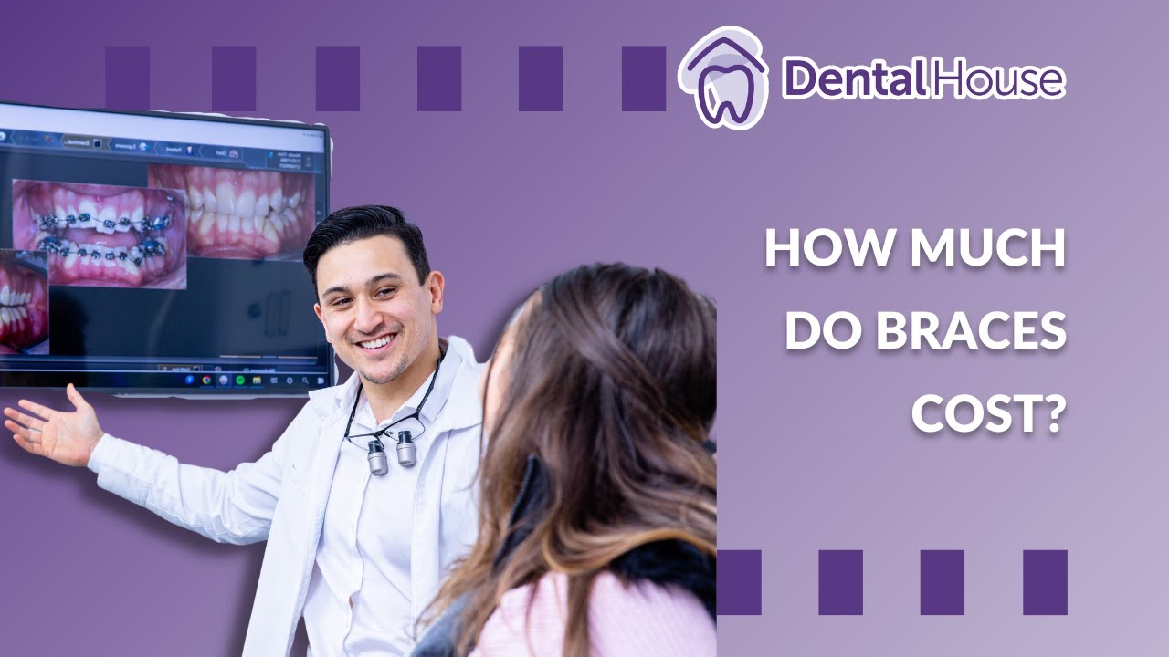 What is the average price of braces in Ireland? Tipseri