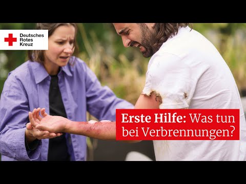 Erste Hilfe: Was tun bei Verbrennungen?