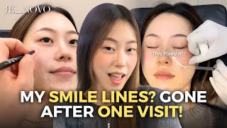 How I Got Rid of My Smile Lines Naturally (Non-Surgical) in Korea 💆‍♀️✨