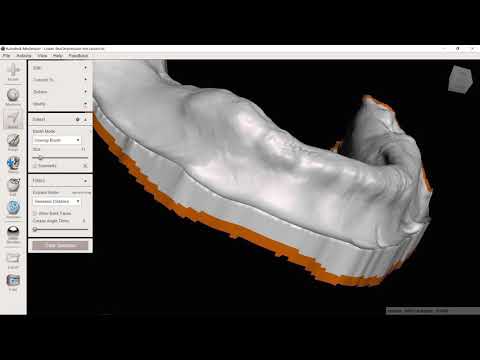 Creating a solid dental model for 3d printing