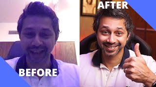 How to improve your Video Calls and live streams