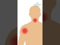 Heart Attack Symptoms Chest Pain Continental Hospitals Heartattack Symptoms Chestpain​