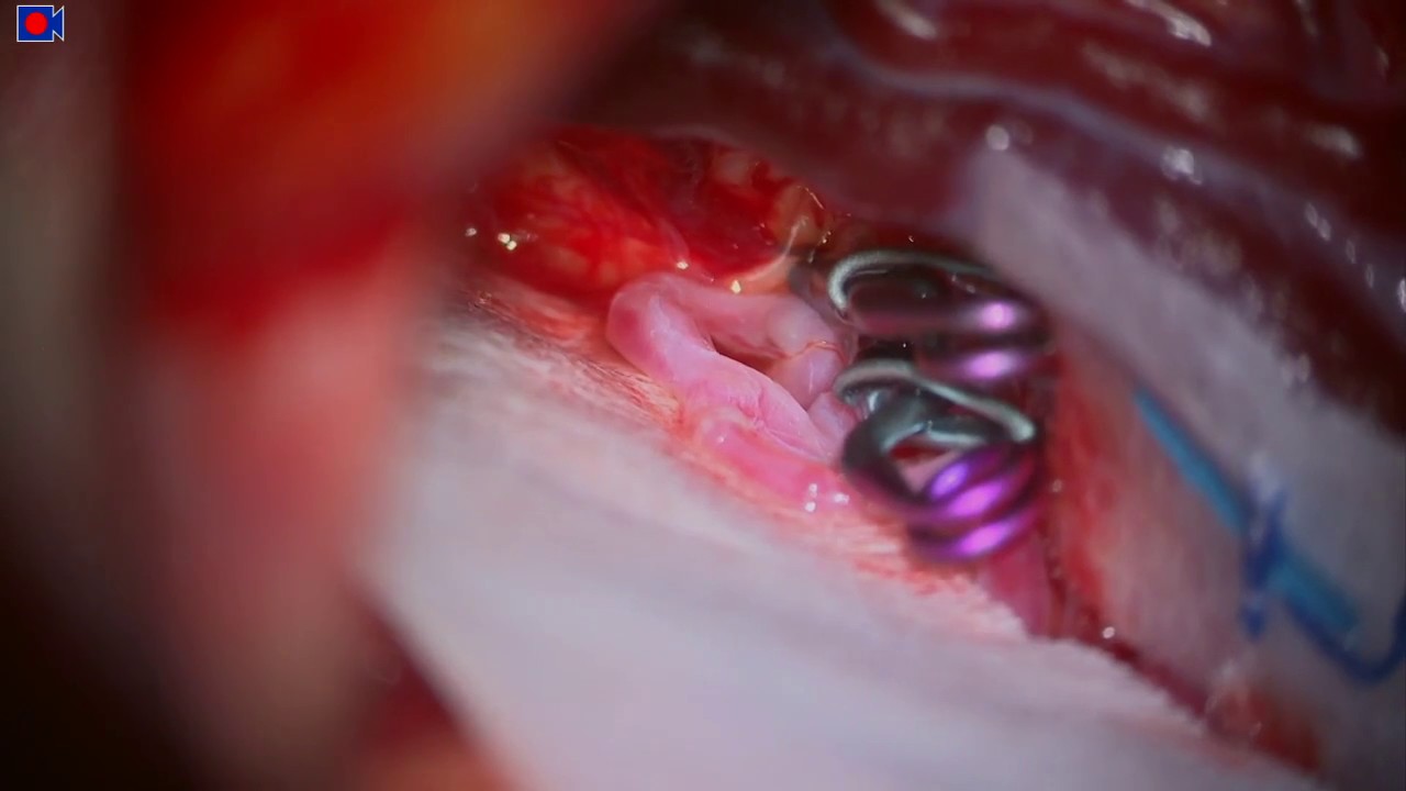 Eliseu Becco Neto-13