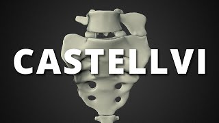 Castellvi classification of lumbosacral transitional vertebrae