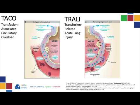 Critical Care: TACO and TRALI- APSA 2020