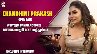 Download lagu எனக்கு Pandian Stores Deepika மாதிரி Acne வந்துச்சு..! - Chandhini Prakash Open Talk | Beauty Secret mp3 Download lagu எனக்கு Pandian Stores Deepika மாதிரி Acne வந்துச்சு..! - Chandhini Prakash Open Talk | Beauty Secret mp3
