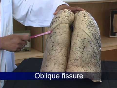 Thorax DVD   1 of 4   The Thoracic Cage & The Thoracic Wall