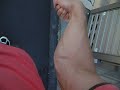 前腕の筋肉チェック その2 My Forearm