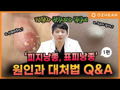"피지낭종 표피낭종 대처법" 15년차 성형외과 전문의가 알려드립니다. ㅣ #종기 #혹 #양성종양 #여드름