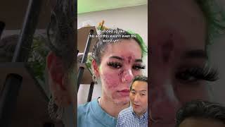 What Happens When You Apply Expired Skin Care Products!