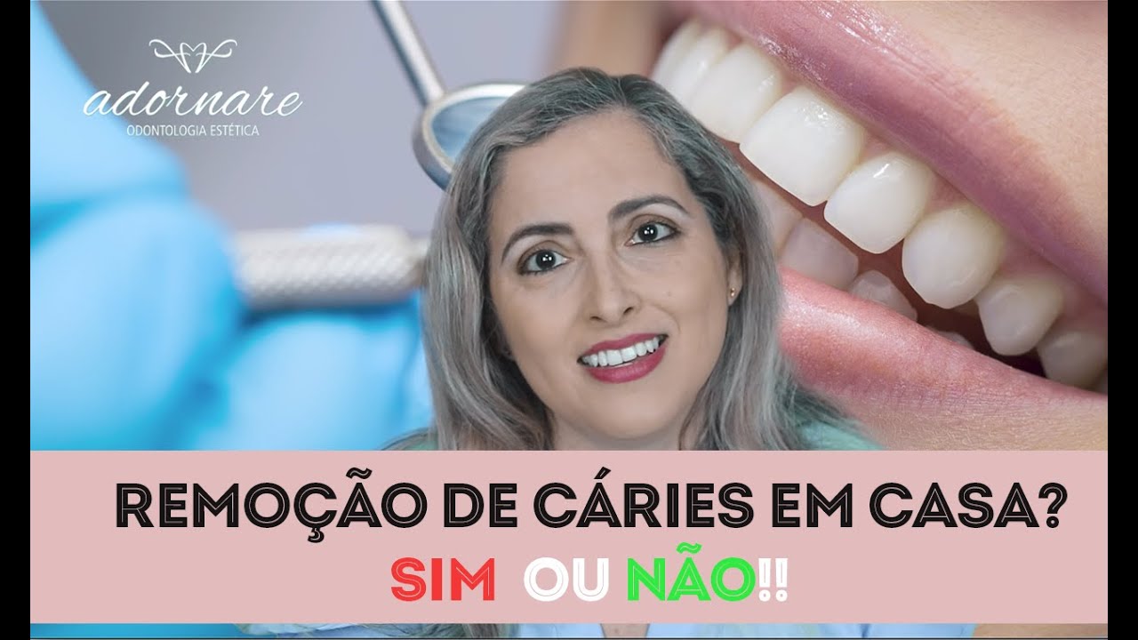 Como Tratar a Cárie em Casa?  É Possível?  - Dra. Cíntia Amorim - Adornare Odontologia