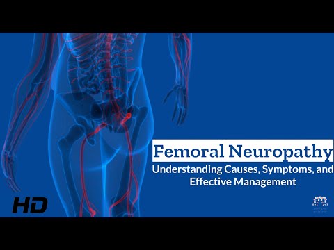 Femoral Neuropathy Unveiled: What You Need to Know