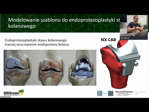 Implanty, szablony, ortezy. Druk 3D i modelowanie w NX CAD. Nagranie webinaru - zdjęcie