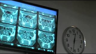 ENT - Dr Nabil Galal - Chronic sinusitis