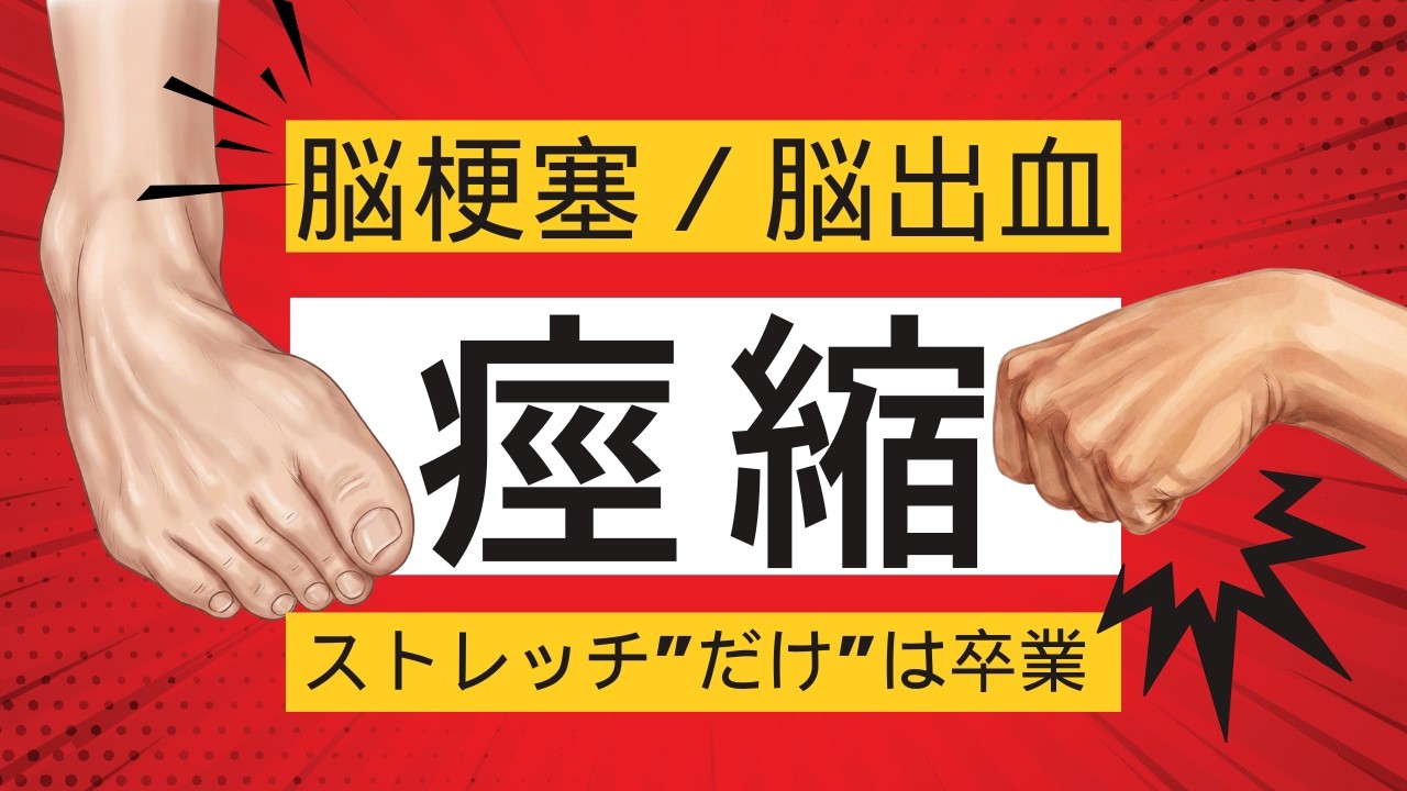 痙縮｜ストレッチ“だけ”は卒業