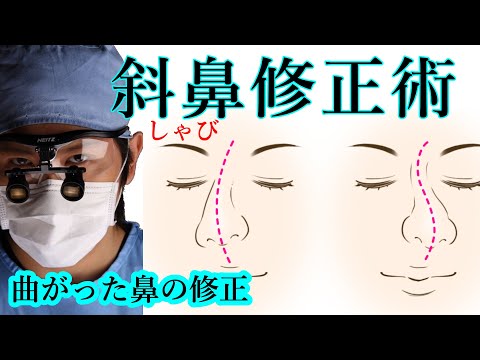 鼻整形手術の具体的方法 斜鼻修正手術 鼻整形なら大阪のグローバルビューティークリニック