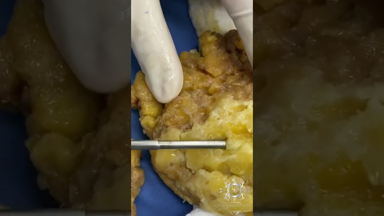 Ana Lucia Rave Martinez-31