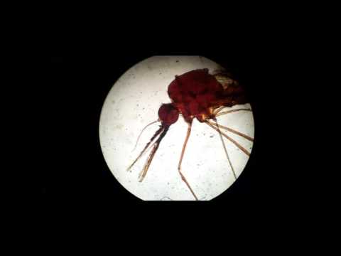 Wonderful things under the microscope - Parasitology Pictures