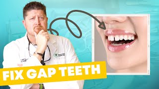 Why You Have GAP TEETH & How to Fix It