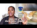 HOW TO GET RID OF DARK INNER THIGHS BIKINI LINES FASTER NATURALLY