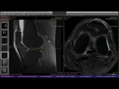 Lecția de genunchi 17